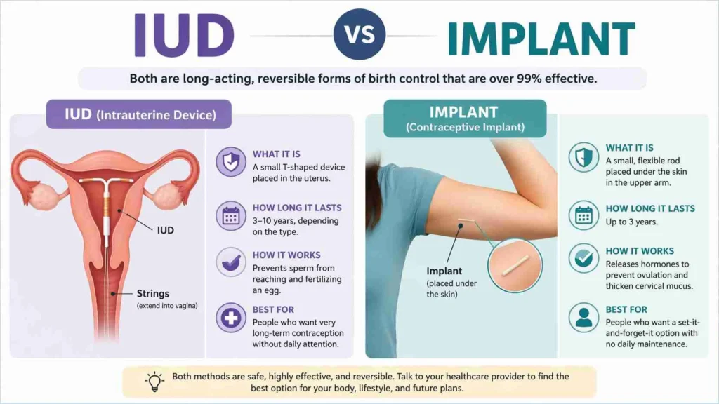 iud vs implant